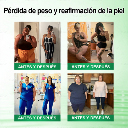 🎁 ¡Solo quedan 5 cajas! ¡Te ofrecemos un 50% de descuento adicional! Ponte en forma y mantente saludable. Pierde peso ahora o quizá no tengas otra oportunidad hasta el próximo año.